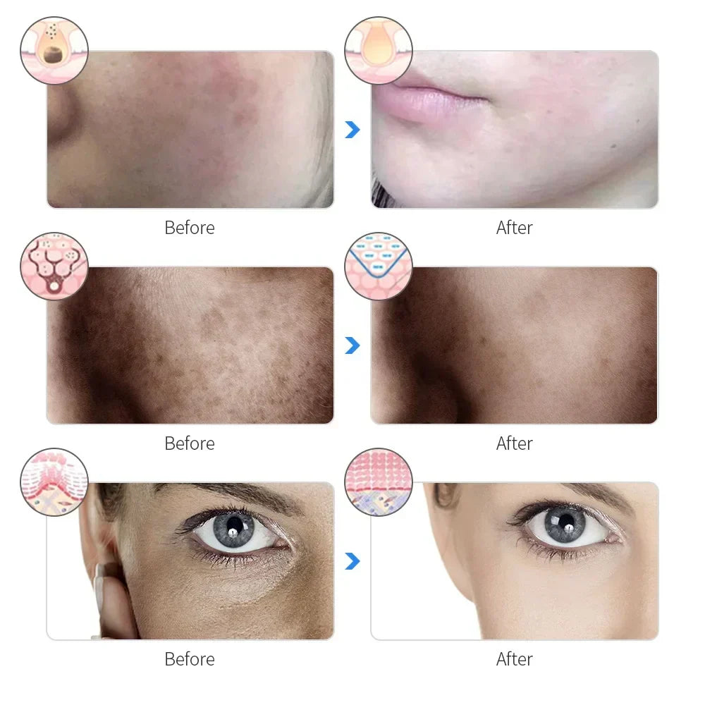 7-Color LED Photon wellness Rechargeable Facial Mask - Skin Rejuvenation & Beauty Device